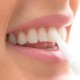 Stylo GEL blanchiment dentaire (Pack de 2)
